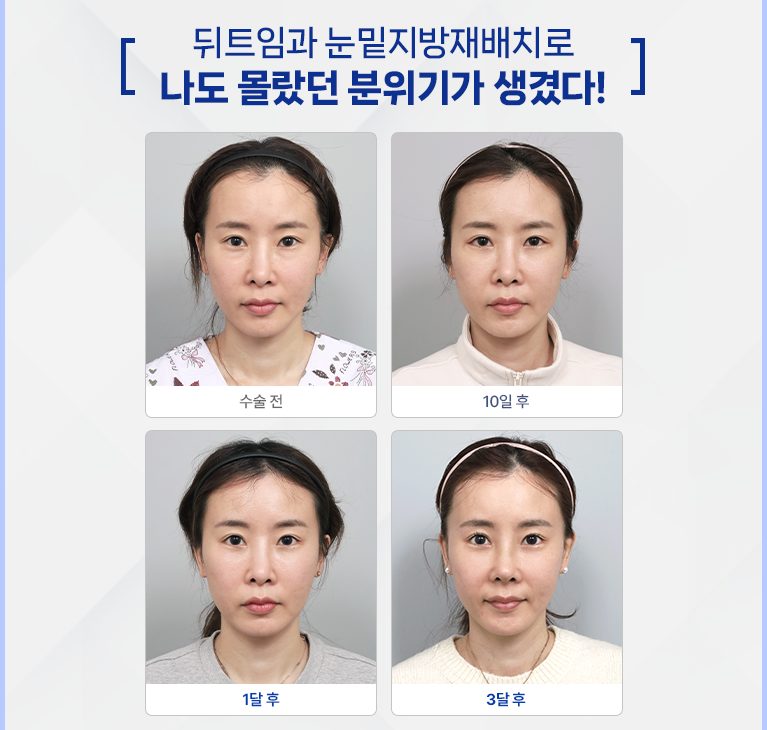 모바일 슬라이드이미지