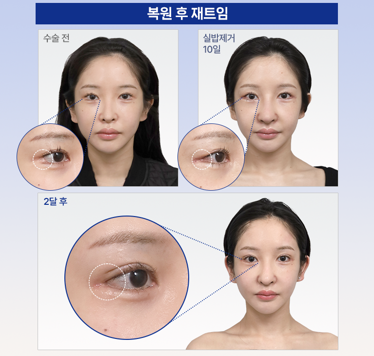 모바일 슬라이드이미지